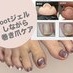 coupon photo